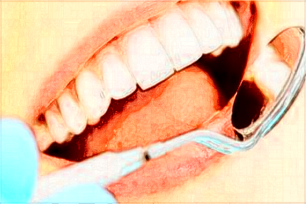 南寧市第一人民醫(yī)院口腔科主任怎么收費(fèi)?口腔科醫(yī)生哪些好