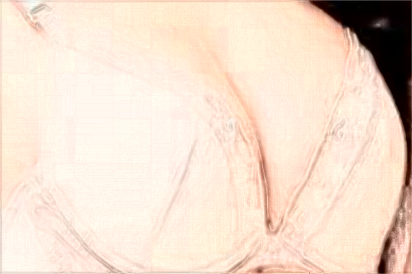 2024中山市人民醫(yī)院整形美容科的價(jià)格表?整形美容科是干什么的