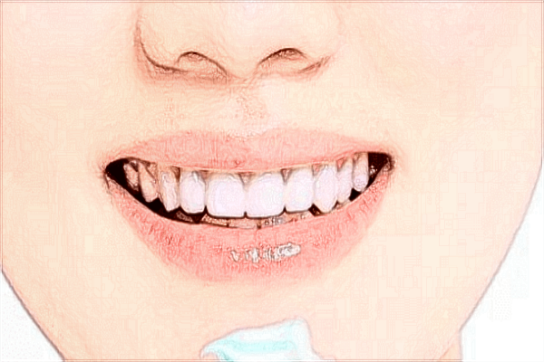 2024中山大學(xué)附屬口腔醫(yī)院種牙多少錢一顆?種牙一顆要多久