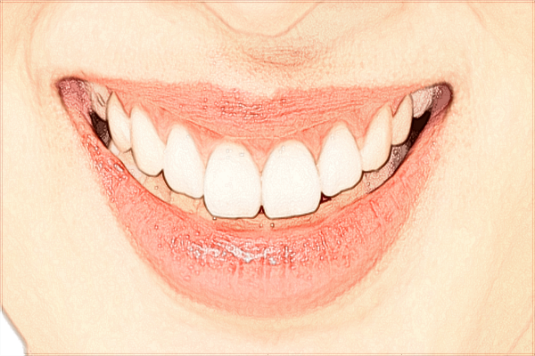 中山大學附屬口腔醫(yī)院牙齒美白哪種方法好?2024牙齒美白價格