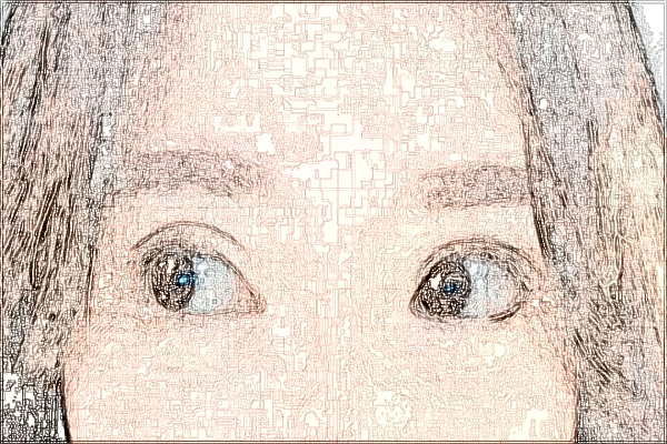 2024中山市人民醫(yī)院飛秒手術(shù)價格?飛秒手術(shù)有風險嗎