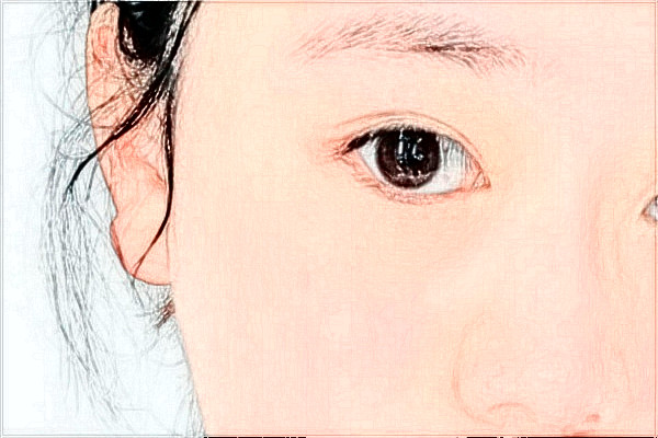 2024臺(tái)州醫(yī)院飛秒做的好嗎_誰做的比較好