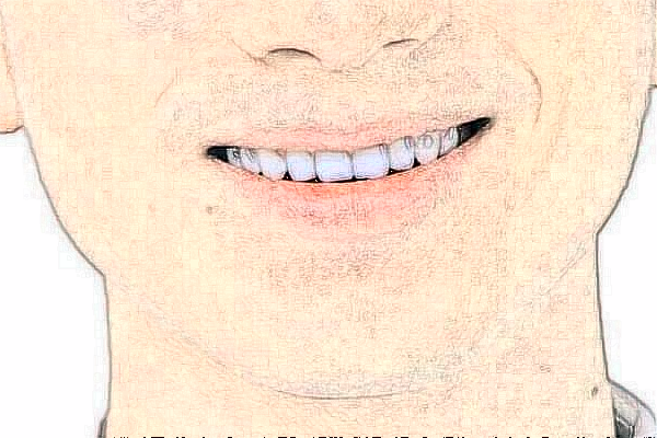 臺(tái)州醫(yī)院口腔科拔牙怎么樣_價(jià)格+案例分享