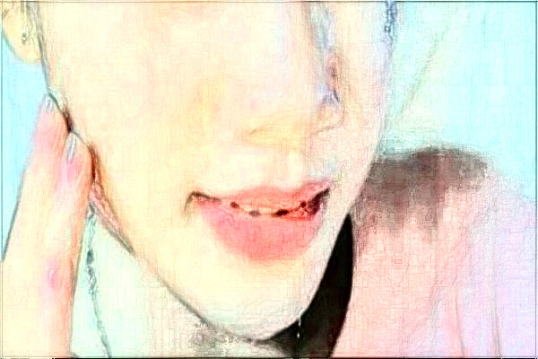 2024徐州市中心醫(yī)院祛斑做的好嗎_恢復案例