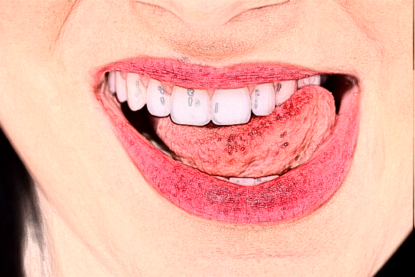 臺(tái)州醫(yī)院牙齒矯正做的好嗎_誰做的比較好