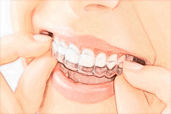 2024泉州180醫(yī)院牙科收費價目表?牙科醫(yī)生怎么樣