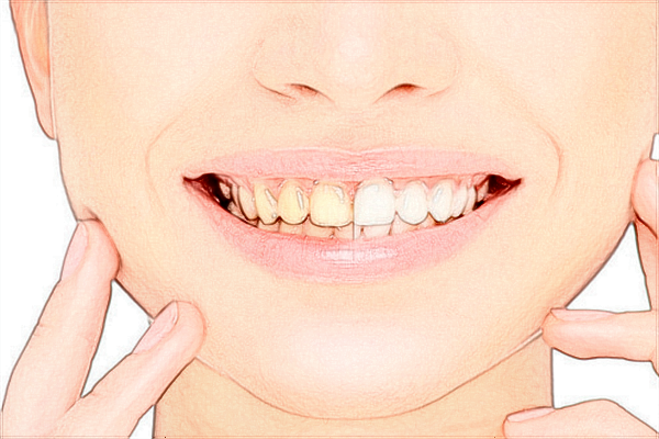 武漢大學(xué)口腔醫(yī)院口腔科醫(yī)生好嗎?2024口腔科收費(fèi)價(jià)目表