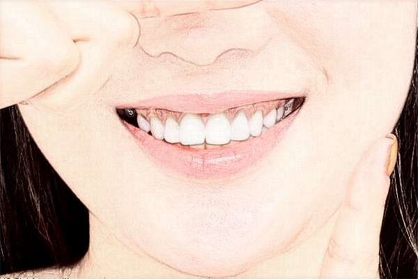 2024珠海市人民醫(yī)院種植牙價(jià)格?種植牙能維持幾年