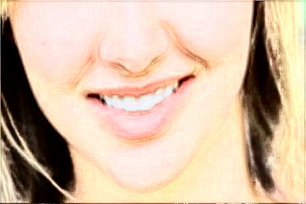 阜陽市人民醫(yī)院激光祛斑案例分享_醫(yī)院介紹