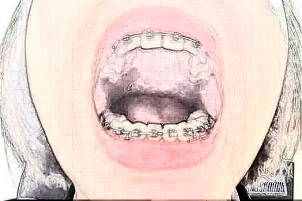 蘇州牙科醫(yī)院排行榜前五強(qiáng)揭曉!2024哪家技術(shù)好？