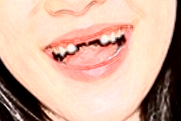 天津人民醫(yī)院