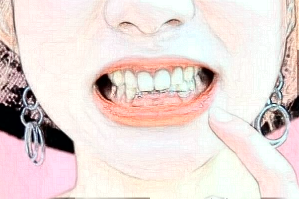 天津市口腔醫(yī)院根管多少錢_做的好嗎？