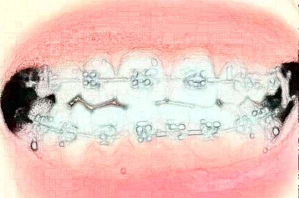 徐州市中心醫(yī)院口腔科張靜醫(yī)生技術(shù)好不好_擅長哪些項目