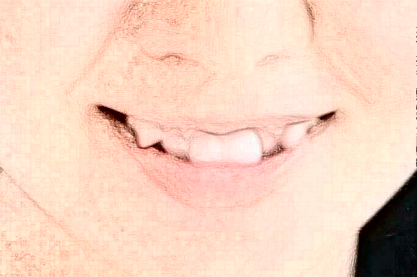 徐州市中心醫(yī)院口腔科張靜醫(yī)生技術(shù)好不好_擅長哪些項目