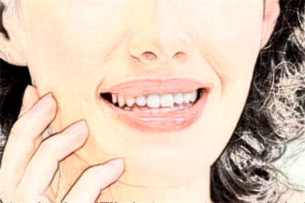 2024泉州180醫(yī)院祛疤怎么樣?激光祛疤價格多少?