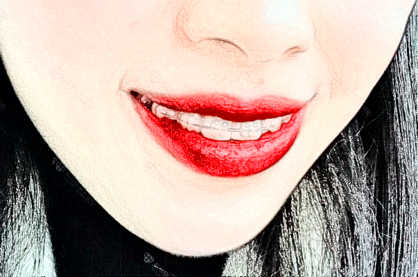 2024金華市中醫(yī)院口腔科烤瓷牙做的好嗎？哪位醫(yī)生做的好