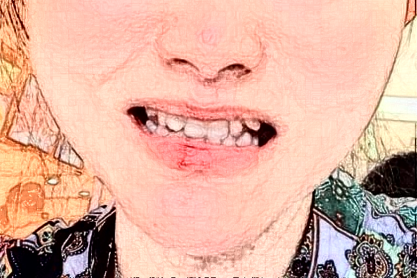 2024哈爾濱242醫(yī)院口腔科義齒修復(fù)怎么樣_醫(yī)生名單推薦