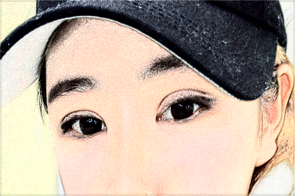 2024金華市中醫(yī)院割雙眼皮怎么樣_醫(yī)生名單推薦