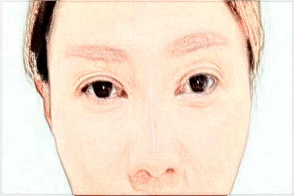 2024金華市中醫(yī)院做眼袋怎么樣_醫(yī)生名單推薦