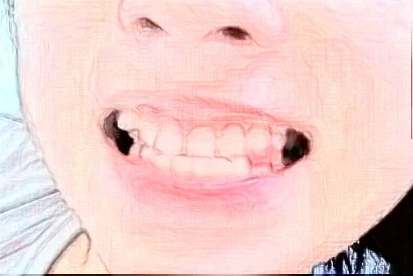 2024天津人民醫(yī)院牙科貴嗎？牙科收費標(biāo)準(zhǔn)