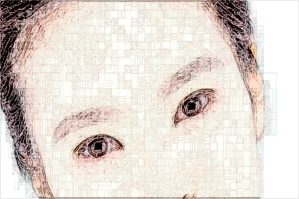 珠海市人民醫(yī)院去眼袋掛哪個醫(yī)生?去眼袋多久恢復正常