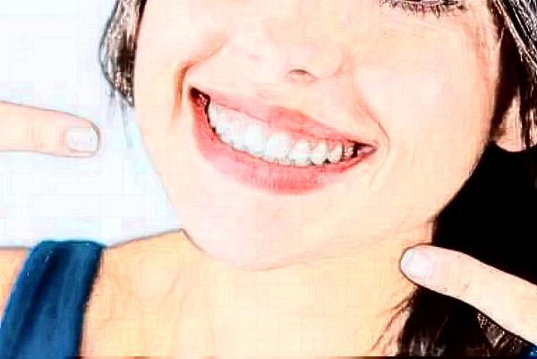 2024哈爾濱242醫(yī)院口腔科烤瓷冠做的好嗎？哪位醫(yī)生做的好