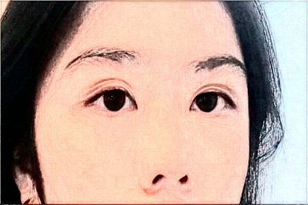 2024哈爾濱醫(yī)科大學(xué)附屬第二醫(yī)院全飛秒多少費用？醫(yī)生推薦