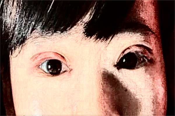 2024哈爾濱242醫(yī)院全飛秒怎么樣【案例日記分享】