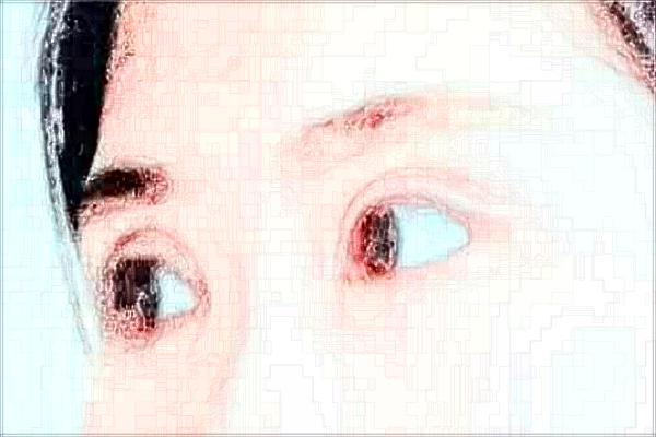 2024蘇州第四人民醫(yī)院近視手術(shù)做的好嗎？哪位醫(yī)生做的好