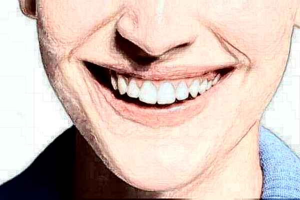 江蘇大學(xué)附屬醫(yī)院口腔科牙齒種植怎么樣_哪個(gè)醫(yī)生比較好