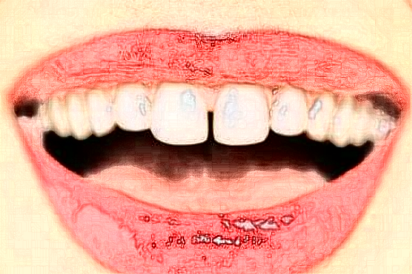 天津市口腔醫(yī)院牙冠哪個醫(yī)生好_專家案例