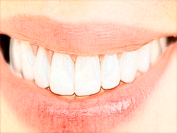 中山大學(xué)附屬口腔醫(yī)院洗牙掛什么科?洗牙好不好?