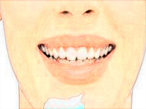 中山大學附屬口腔醫(yī)院洗牙怎么樣?洗牙對牙齒有傷害嗎