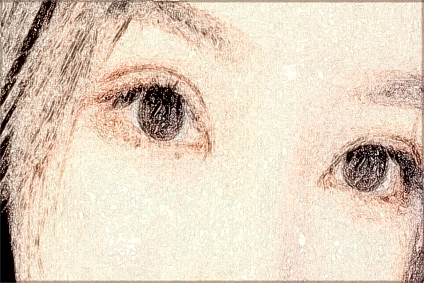 2024中山市人民醫(yī)院半飛秒價(jià)格表?半飛秒和全飛秒?yún)^(qū)別