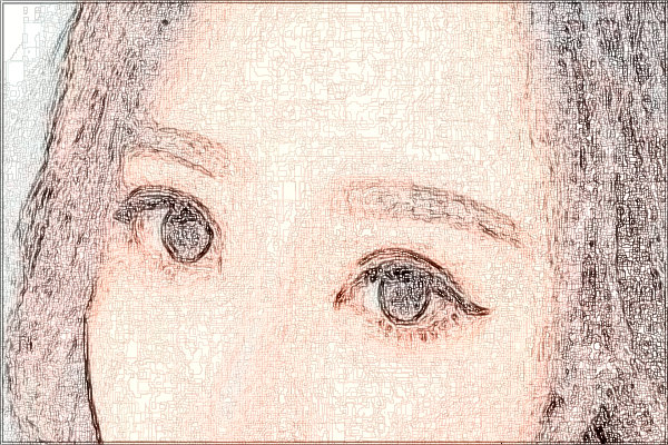 2024珠海市人民醫(yī)院全飛秒手術多少錢?全飛秒手術案例