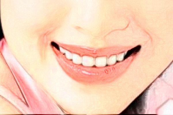 2024天津醫(yī)院口腔科種植牙怎么樣_誰(shuí)做得好