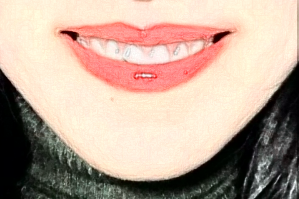 2024天津醫(yī)院口腔科種植牙怎么樣_誰(shuí)做得好