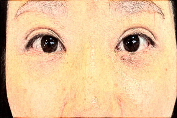 2024蘇州全切雙眼皮整形醫(yī)院排行榜前三！各大機(jī)構(gòu)哪家實(shí)力好？