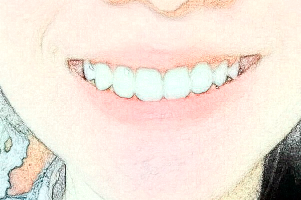 金華市中醫(yī)院口腔科牙齒修復(fù)做的好嗎？哪位醫(yī)生做的好