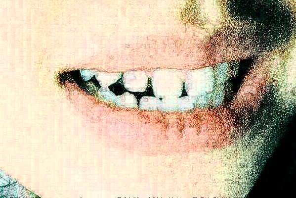 2024太原市中心醫(yī)院口腔科周辰醫(yī)生技術好不好_醫(yī)生簡介