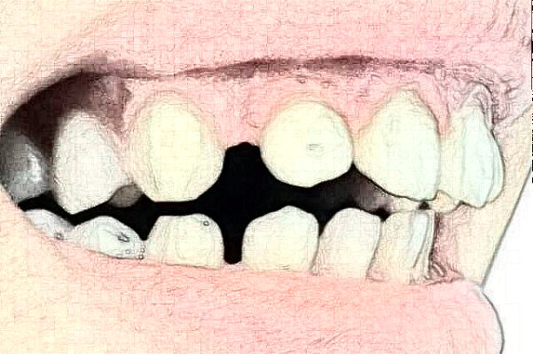 2024太原市中心醫(yī)院口腔科周辰醫(yī)生技術好不好_醫(yī)生簡介