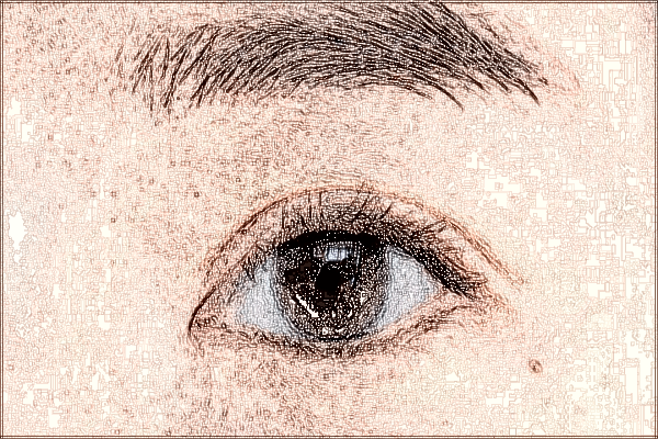 2024中山市人民醫(yī)院飛秒手術(shù)價格一覽表?飛秒手術(shù)后注意事項