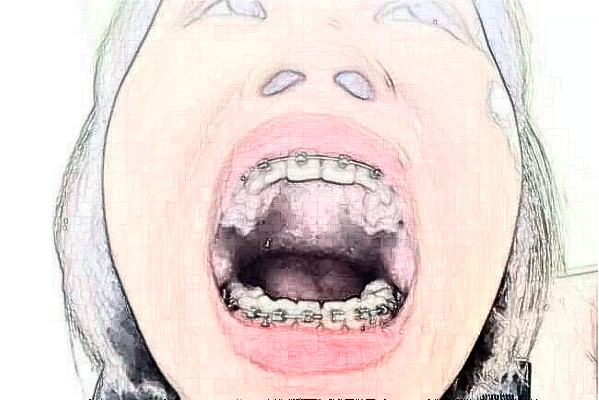 金華市中醫(yī)院口腔科怎么樣_醫(yī)生排名