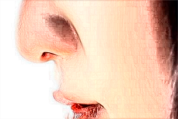 南京鼓樓醫(yī)院熱拉提做的好嗎？誰做的好