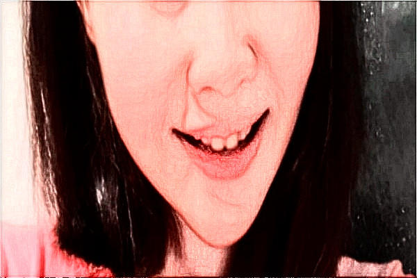 2024溫州醫(yī)學院附屬第二醫(yī)院口腔科面部不對稱矯正誰做的好