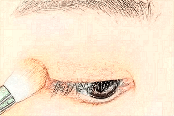 2024中山大學(xué)附屬第一醫(yī)院近視眼手術(shù)多少錢(qián)?近視眼手術(shù)佳年齡