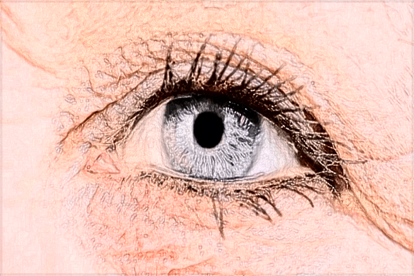 中山大學(xué)附屬第一醫(yī)院近視矯正好嗎?近視矯正有哪些方法