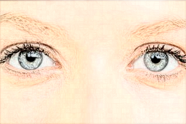 2024佛山市第二人民醫(yī)院割雙眼皮價格?割雙眼皮和埋線哪個好