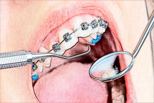 青島市立醫(yī)院口腔科怎么樣?口腔科包含什么項(xiàng)目