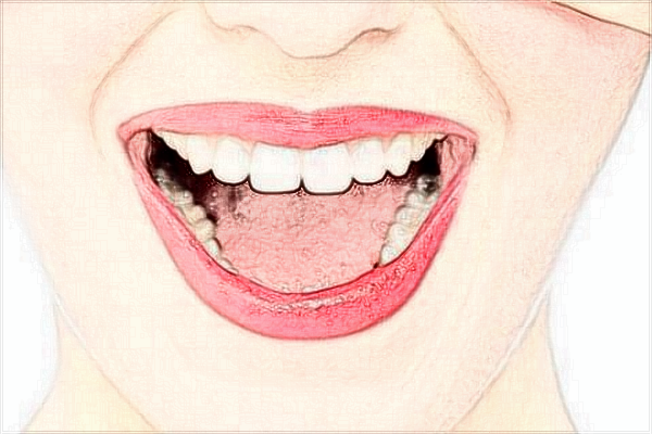 2024中山大學(xué)附屬口腔醫(yī)院種植牙怎么樣?種植牙的價格一覽表